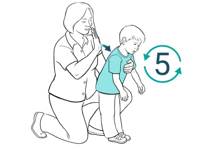 Adult kneeling behind child with one arm across child's chest and other hand raised above child's back, with child slightly bent over. Arrow shows adult giving back blows between child's shoulder blades with heel of hand.